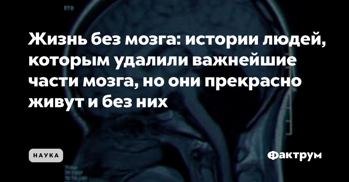 За что мне такому хорошему такая хреновая жизнь креативный антивирус для мозга