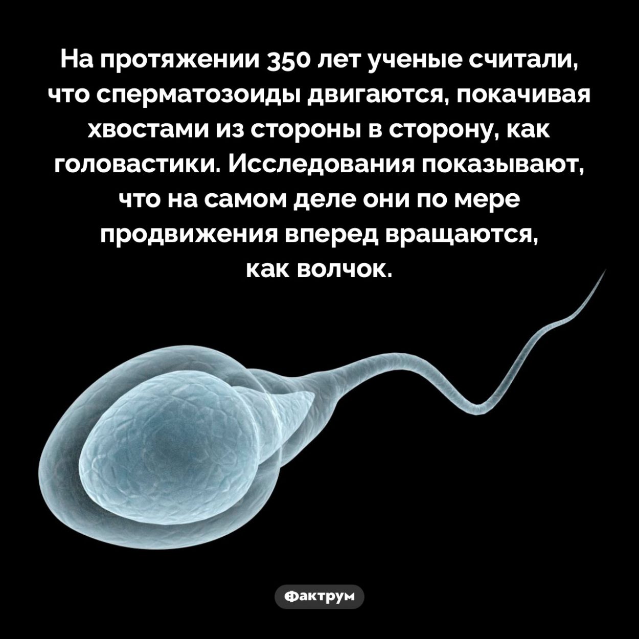 Ненормальный сперматозоид