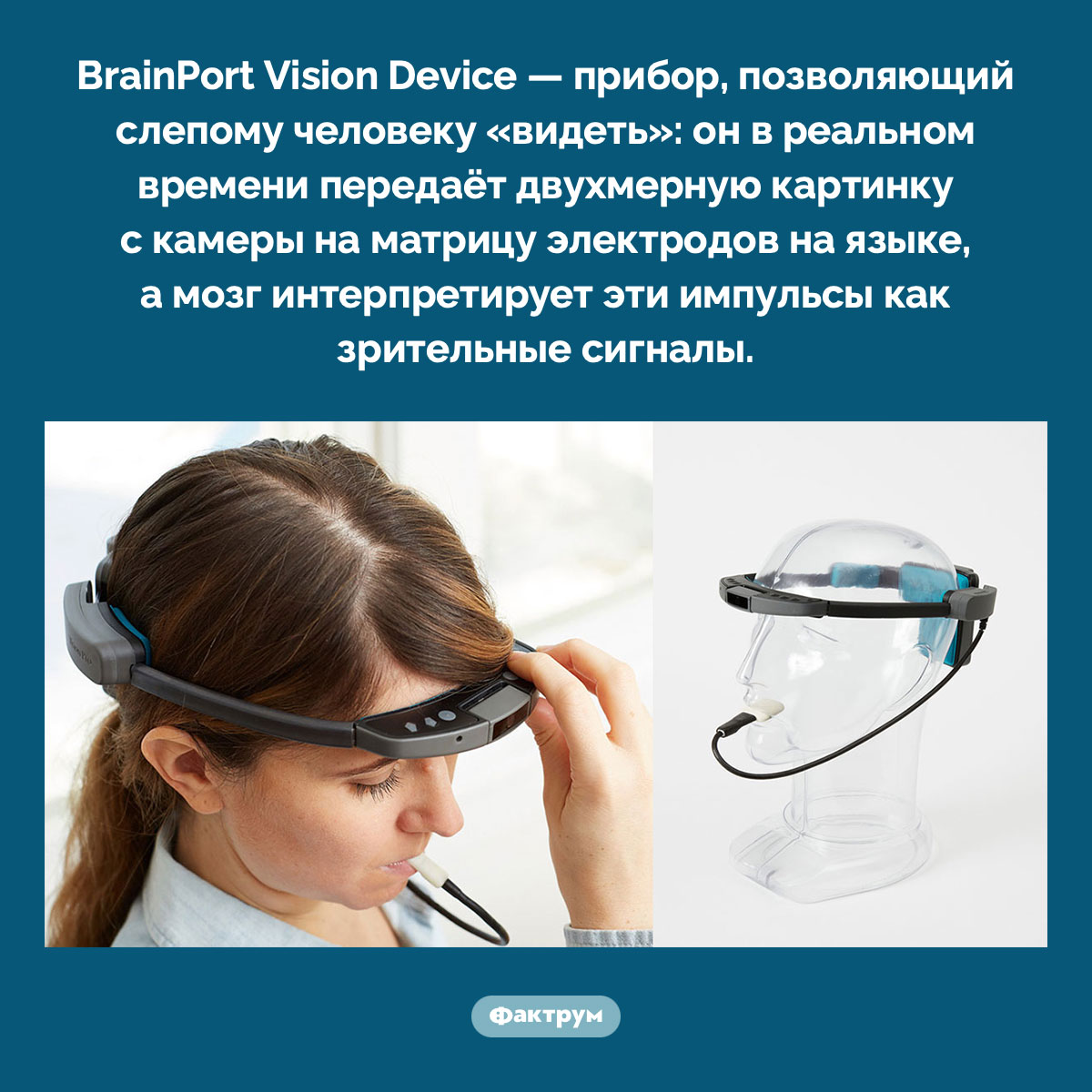 Зрительный аппарат. BrainPort Vision Device — прибор, позволяющий слепому человеку «видеть»: он в реальном времени передаёт двухмерную картинку с камеры на матрицу электродов на языке, а мозг интерпретирует эти импульсы как зрительные сигналы.